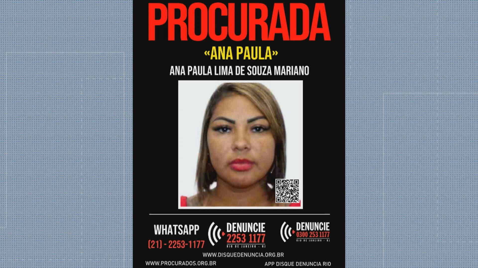 Mais de 20 pacientes denunciam esteticista por dores e sequelas após procedimentos: 'Estou pior do que antes', diz vítima