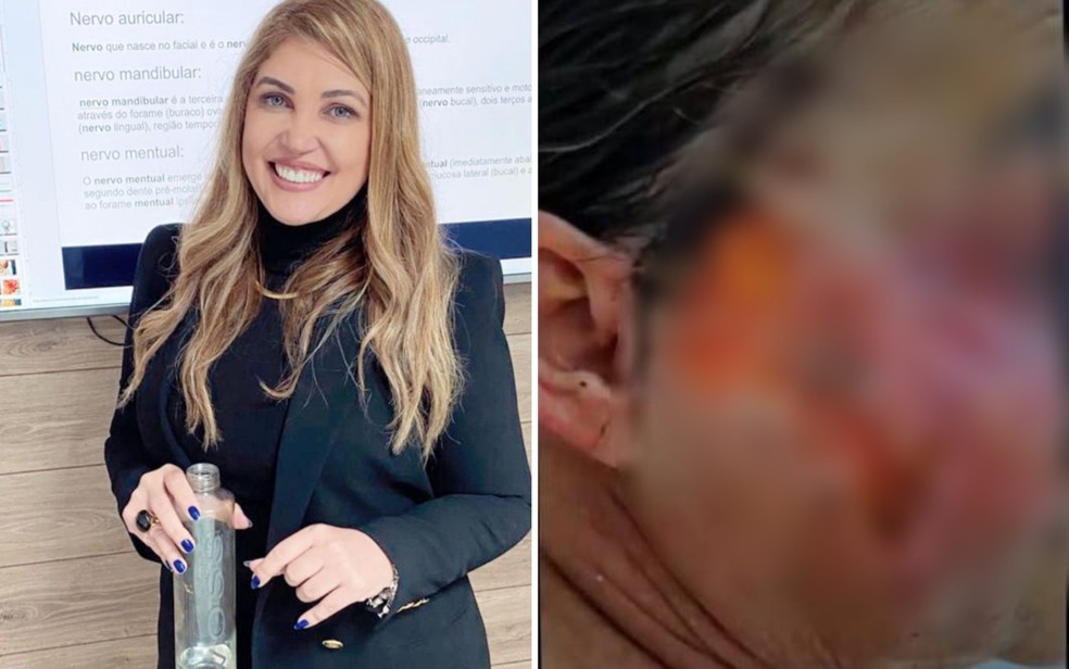Dentista Hellen Kacia Matias da Silva é suspeita de deformar pacientes em cirurgias estéticas, em Goiânia — Foto: Divulgação/Polícia Civil