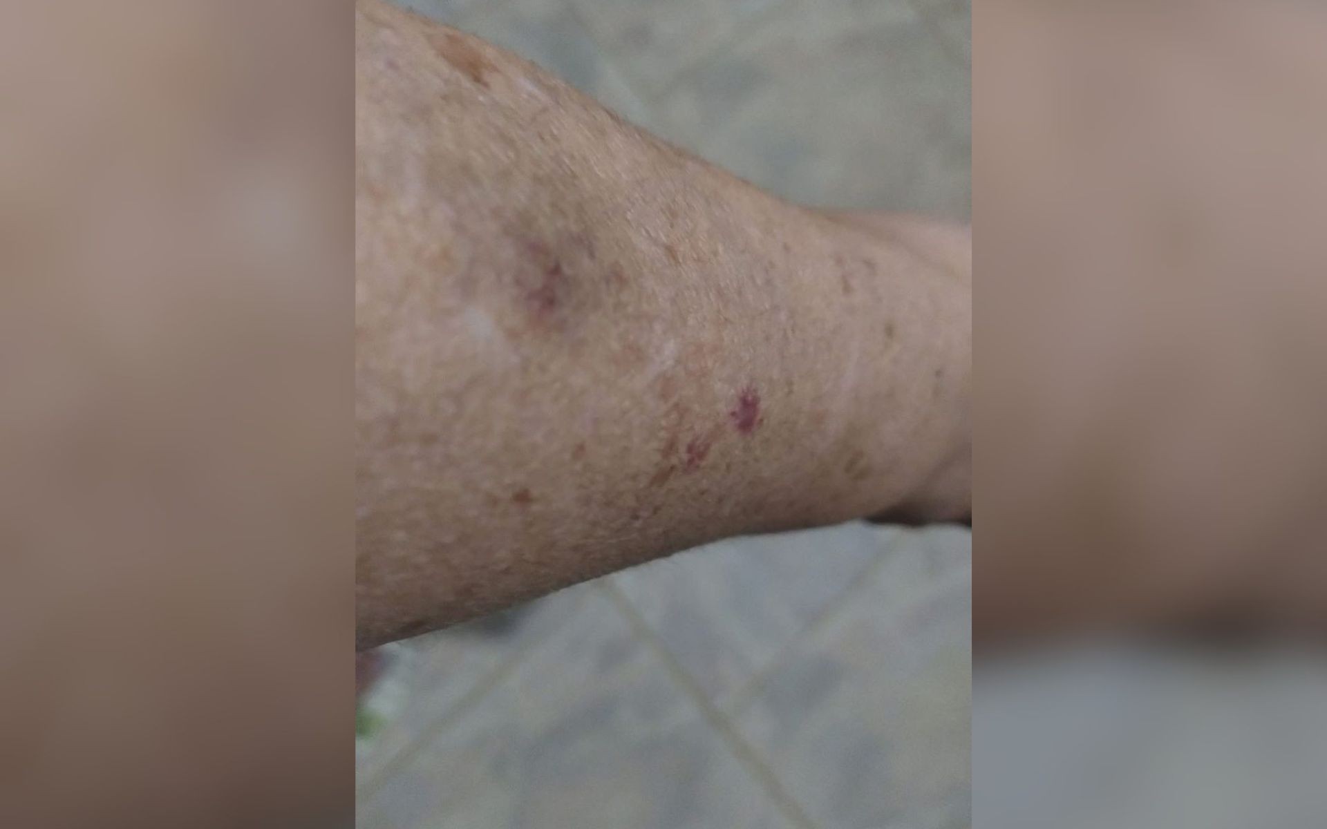 Professora desiste do cargo após ser mordida e chutada por alunos em escola pública no interior de SP: 'Fiquei toda roxa'
