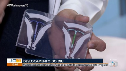 Médica orienta como identificar o deslocamento do DIU