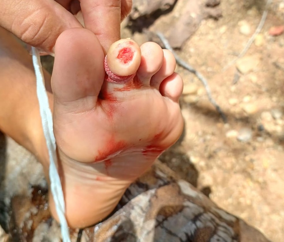Banhistas são atacados por piranhas em rio no interior do RN — Foto: Cedida
