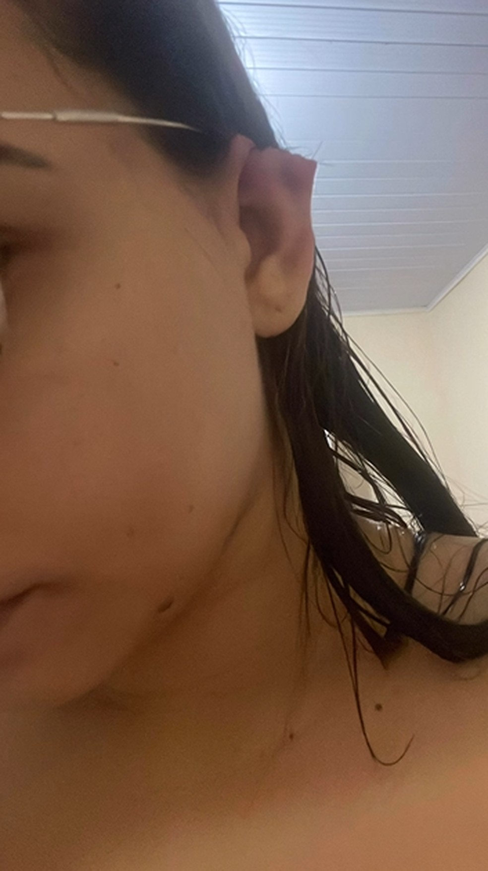 Vítima teve parte da orelha arrancada com uma mordida durante briga em Araguaína — Foto: Reprodução/redes sociais/Raylland Ferreira