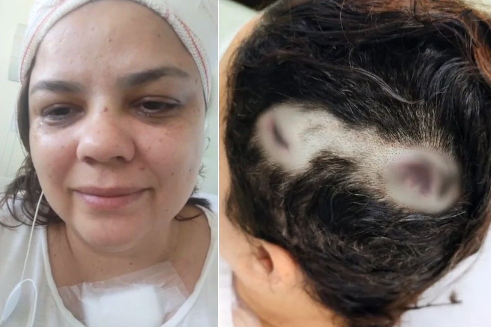 Mulher baleada na cabeça, tórax e mão gravou vídeo emocionada dentro de hospital — Foto: Arquivo Pessoal