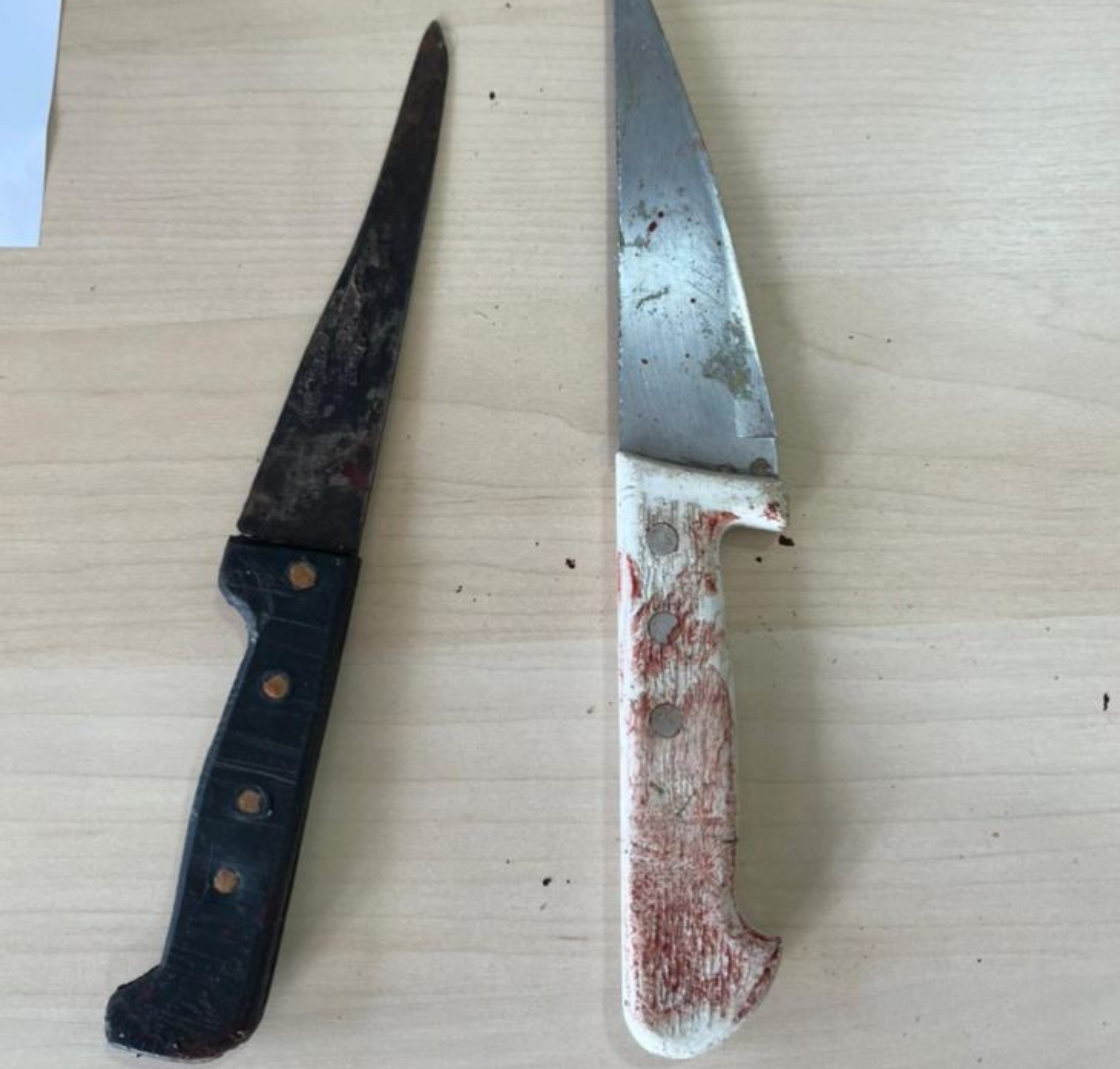 Jovem é esfaqueado nas nádegas e costas por amigo armado com duas facas em Pacaraima