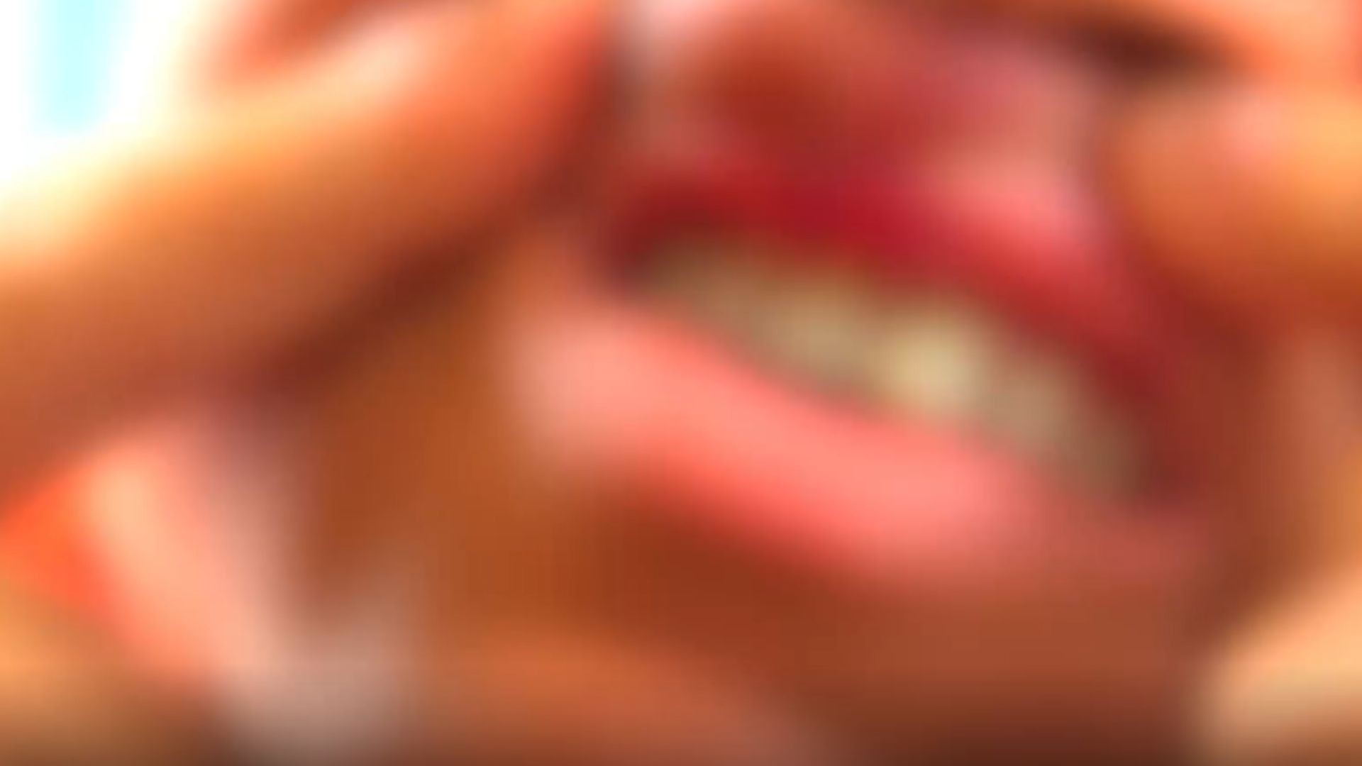 Mulher é agredida e perde dente após reagir a assalto em Cariacica, no ES