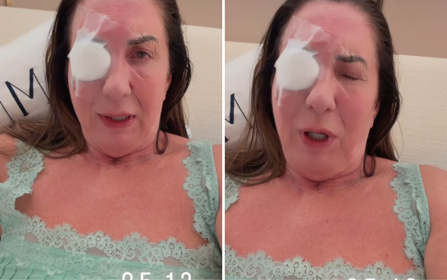 Mãe de Virginia aparece com tampão no olho e diz que teve crise de ansiedade: ‘Foi horrível, não desejo isso para ninguém’