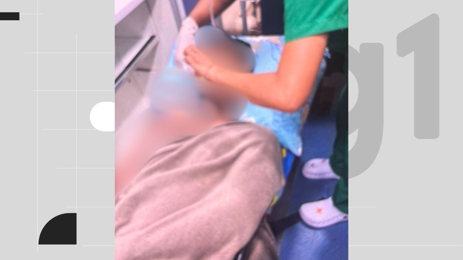 Jovem de 21 anos tem rosto e braço queimados após ataque com água quente no PI; namorada é suspeita, diz PM