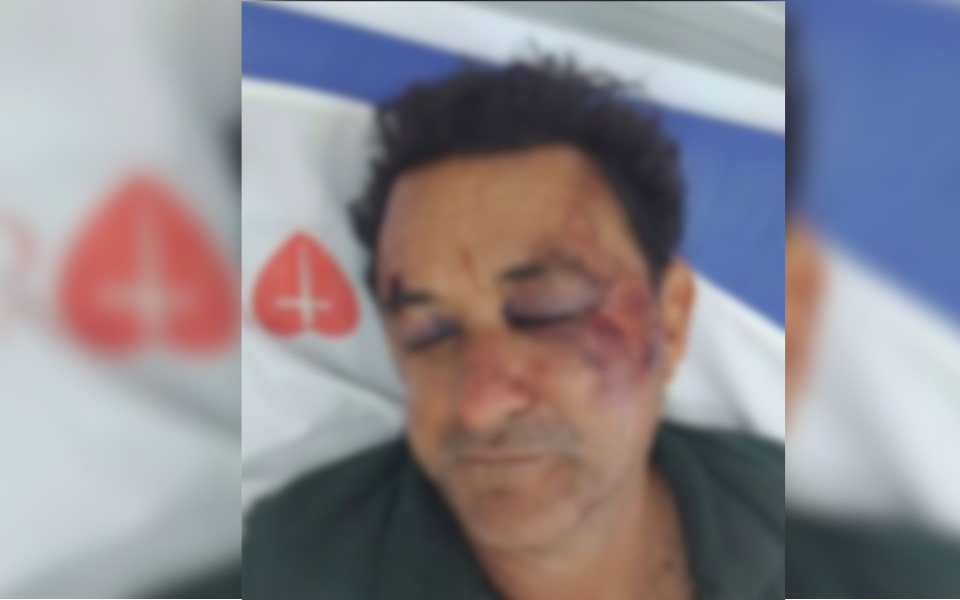 Garçom denuncia ter sido agredido por grupo de jovens em caso de homofobia