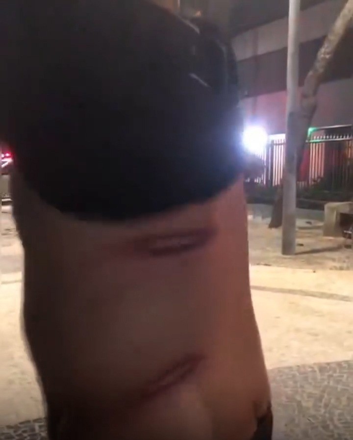 Homem denuncia agressão de agente da Seop durante ação de limpeza no Arpoador; servidor foi afastado 