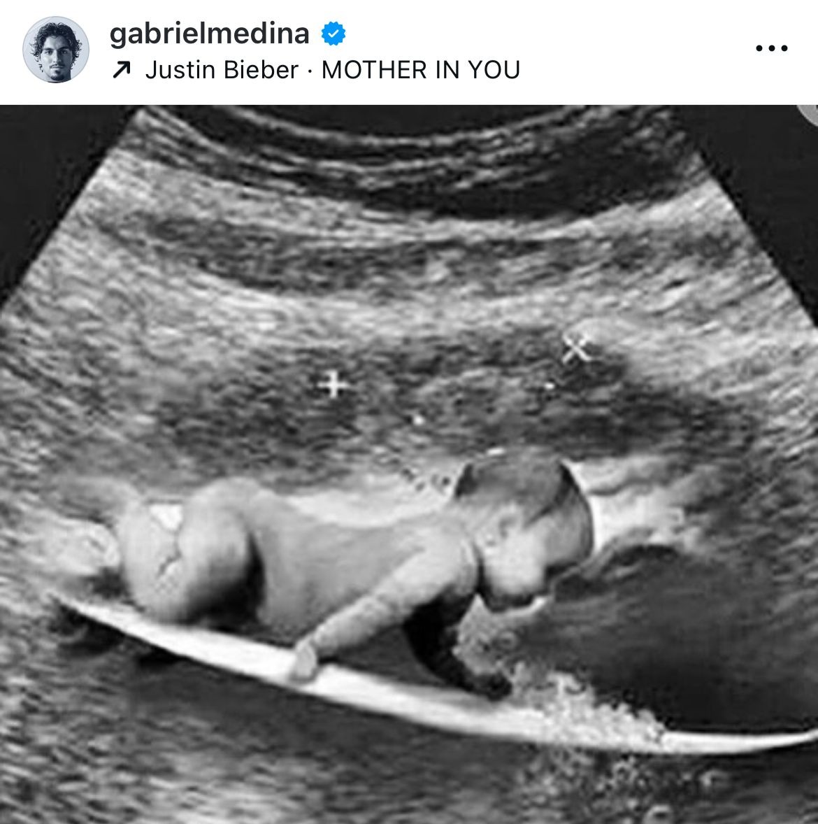 Gabriel Medina posta foto de bebê em prancha e levanta rumor de gravidez com Isabella Arantes