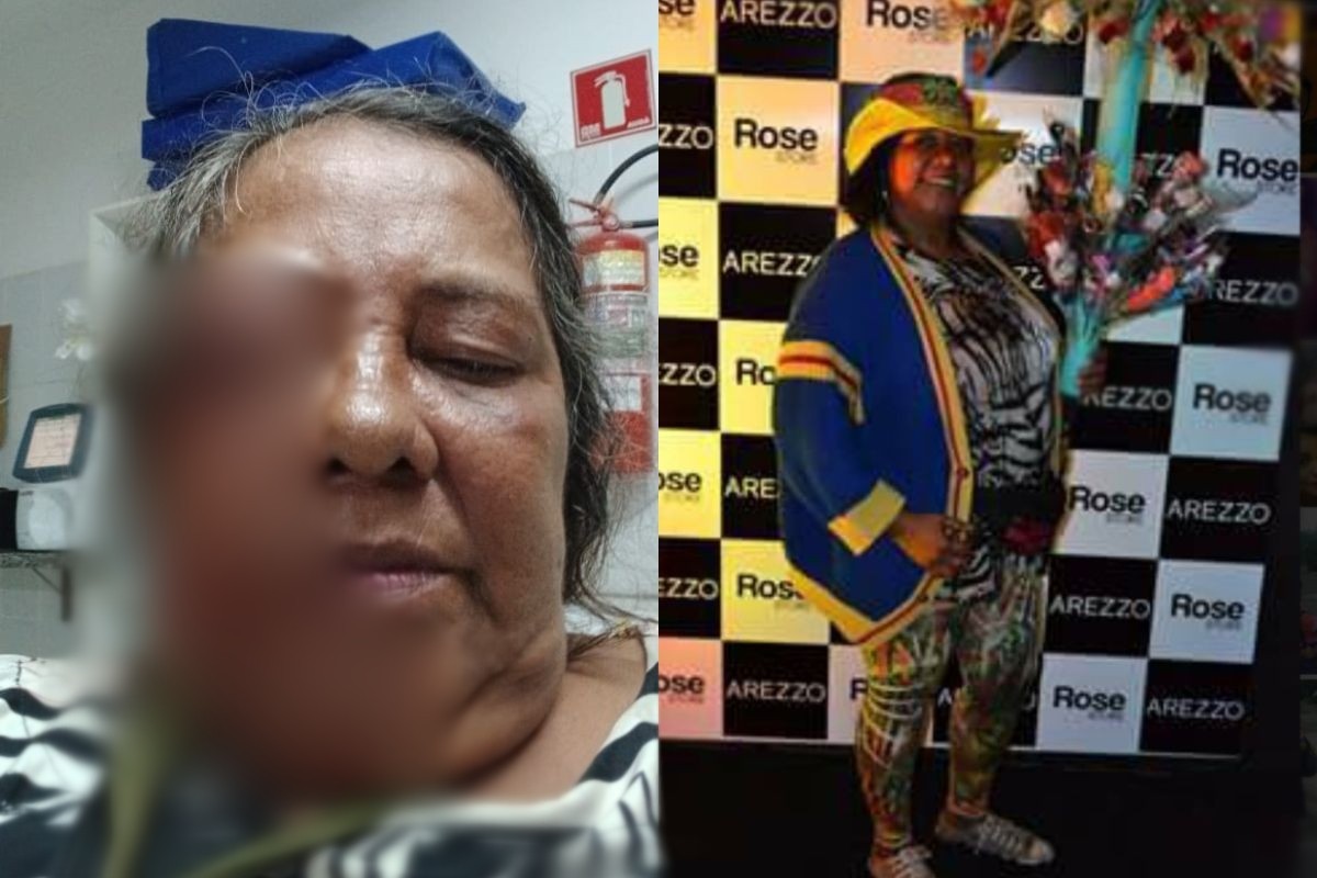 Florista tem ferimento no olho durante ao da PM em Campo Grande