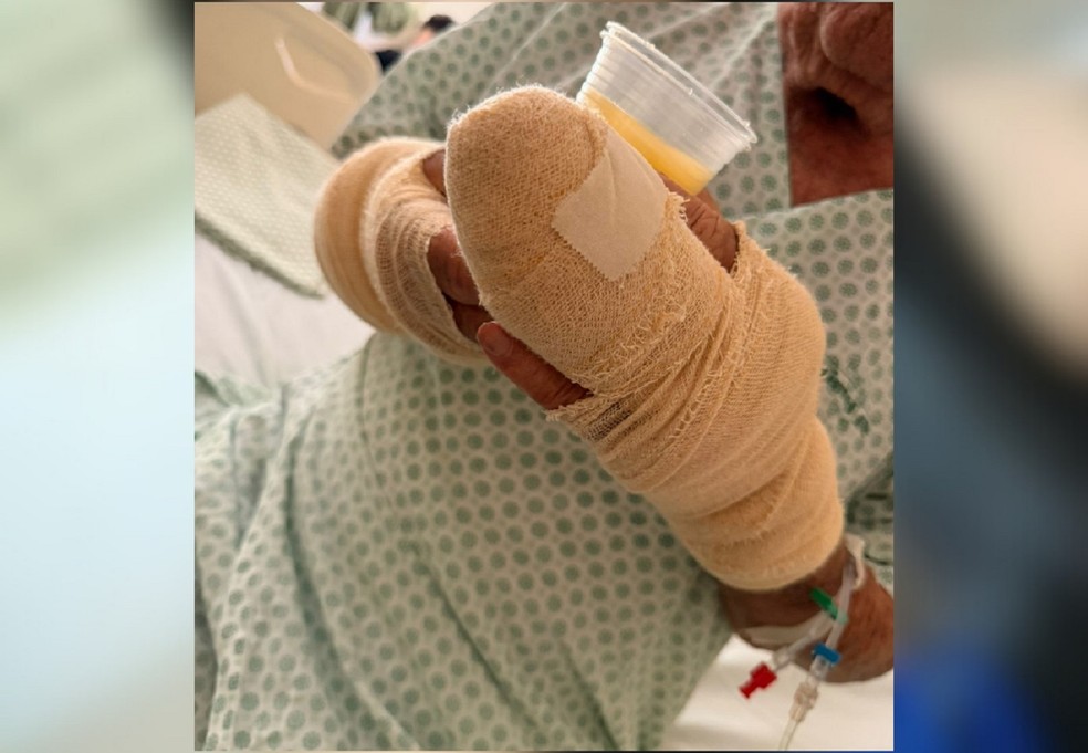 Idoso de 83 anos ficou gravemente ferido após ser atacado por pitbull em Palmas — Foto: Arquivo Pessoal/Lorena Ruiz