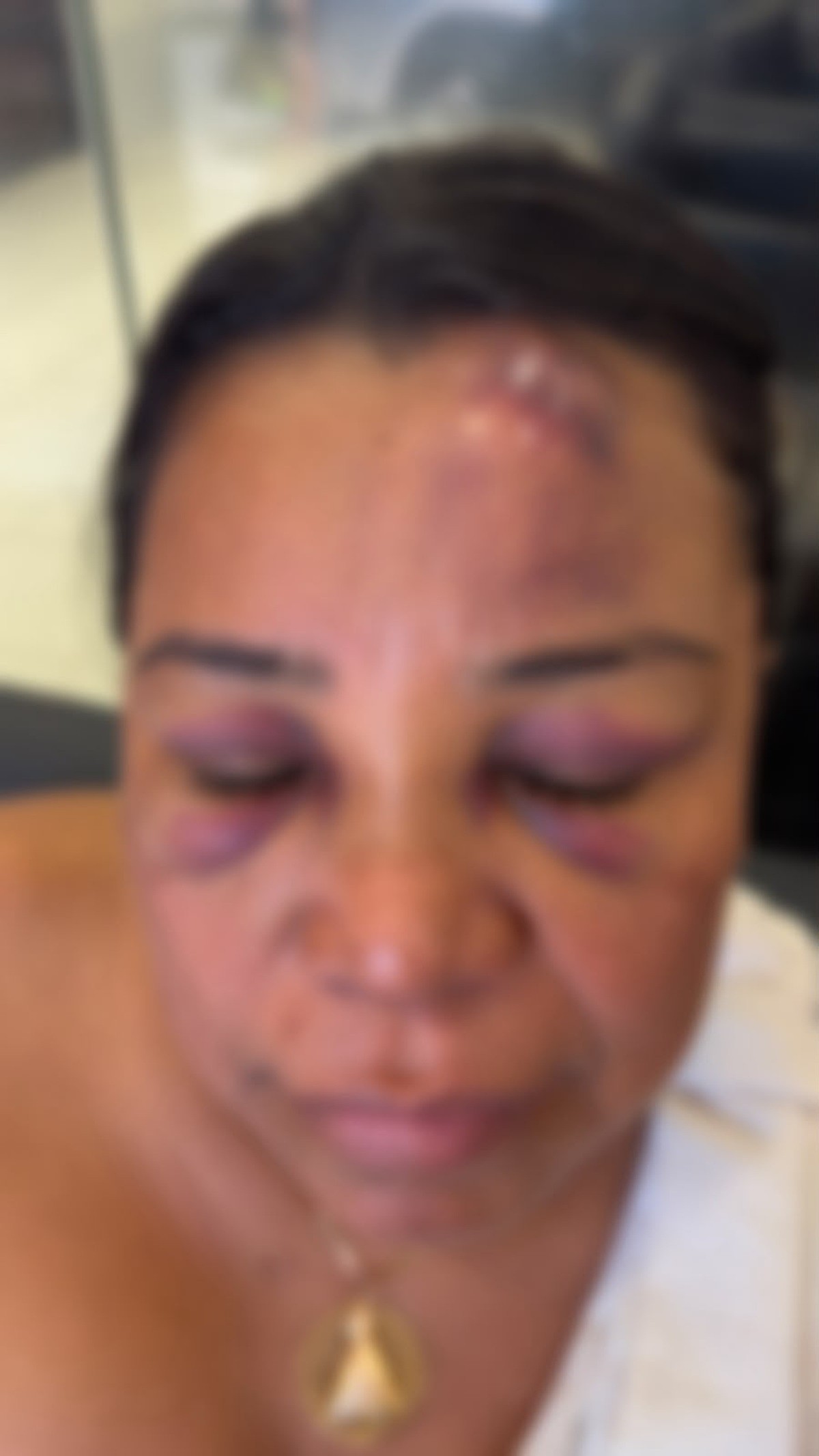 Mulher denuncia agressão de PMs no São João de Maceió; VÍDEO