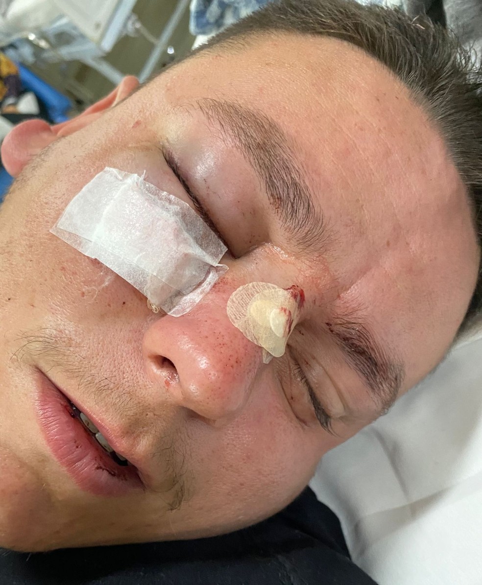 Cliente é agredido por policial militar com cotovelada no rosto em padaria de Jacareí, SP — Foto: Arquivo pessoal