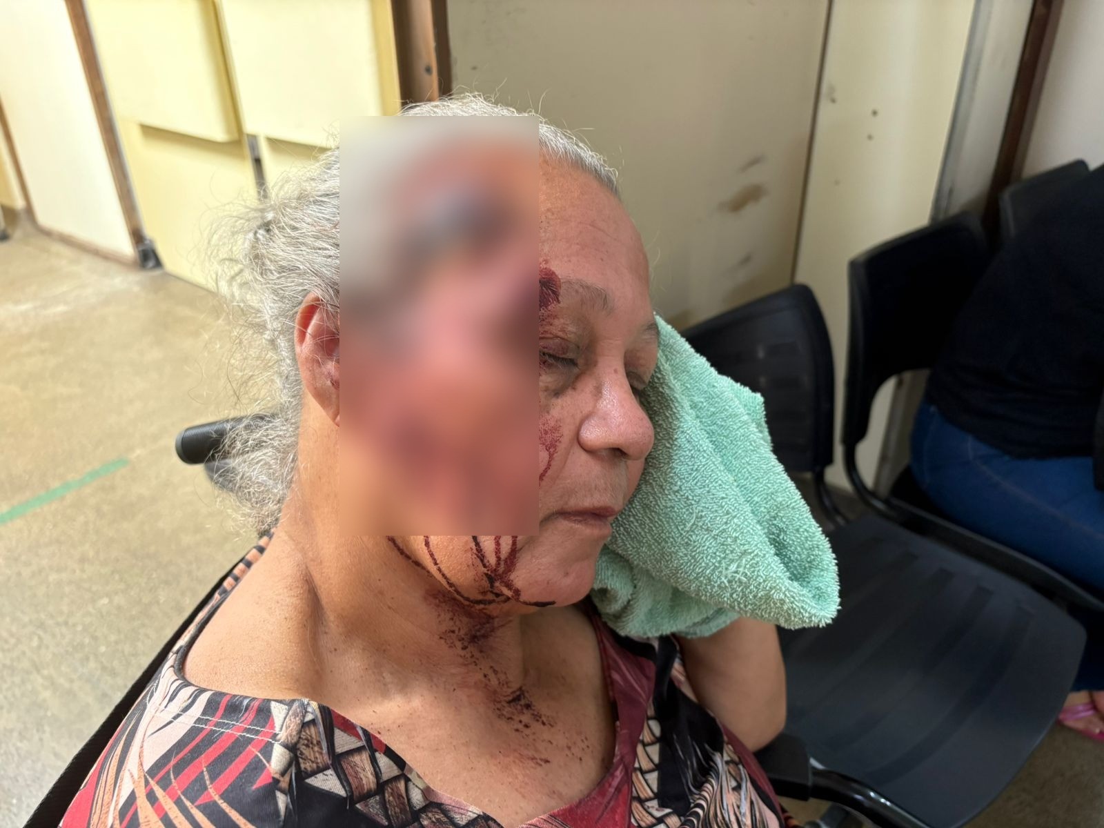 Idosa cai e bate a cabeça após descer de ônibus no DF; motorista não prestou apoio