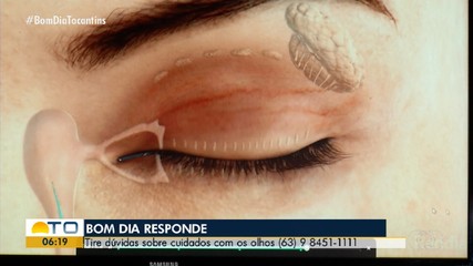 Bom Dia Responde tira dúvidas sobre cuidados com os olhos
