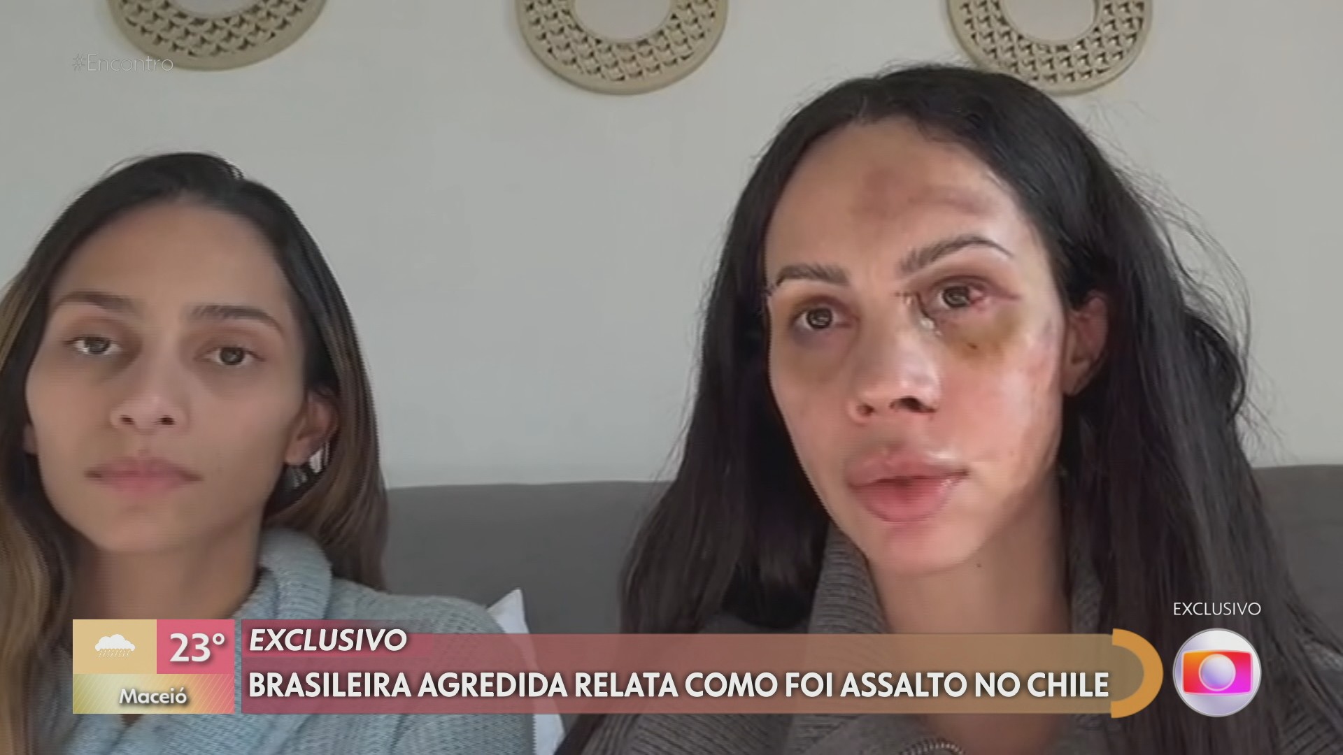 Paranaense espancada durante assalto no Chile chega ao Brasil 