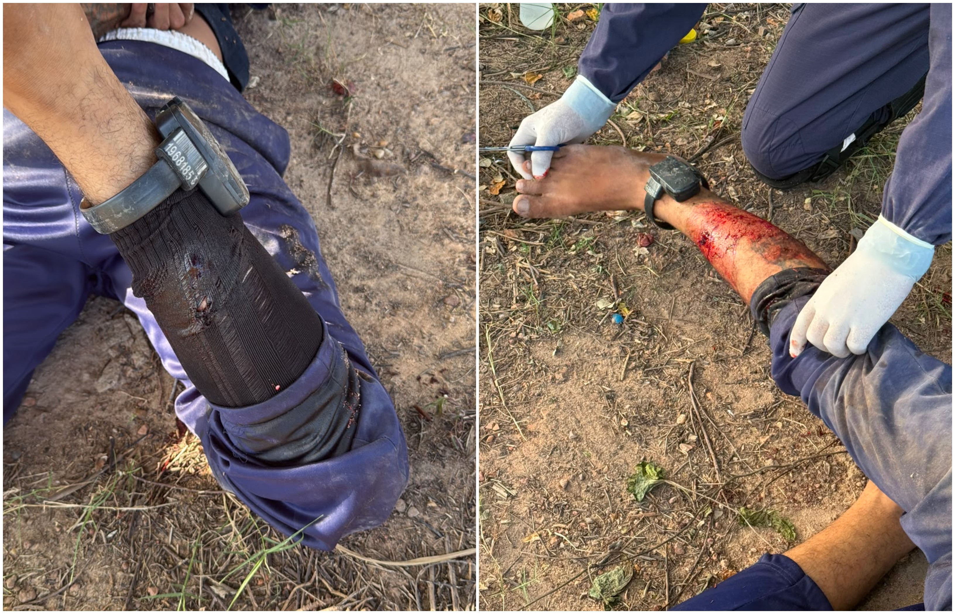 Homem é baleado e preso após perseguição e troca de tiros com a PM em Boa Vista
