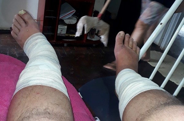 Fot&oacute;grafo de Araras que morreu usava curativo nas pernas &mdash; Foto: Reprodu&ccedil;&atilde;o/Facebook