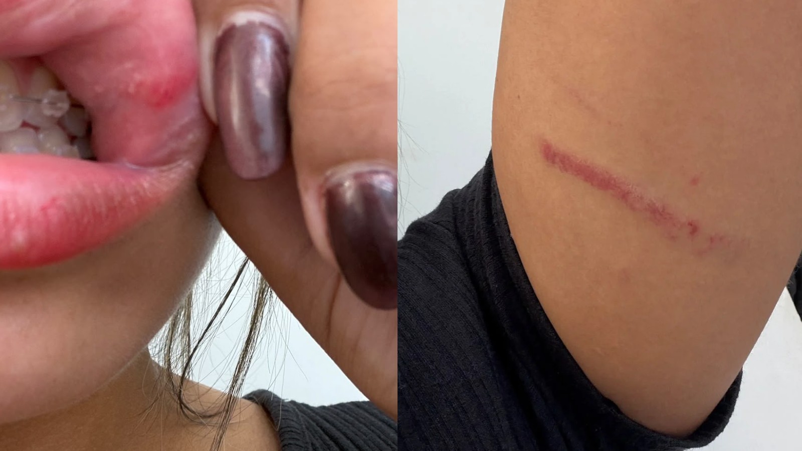 Jovem diz ter sido agredida por motorista de aplicativo após discussão durante corrida em Teresina