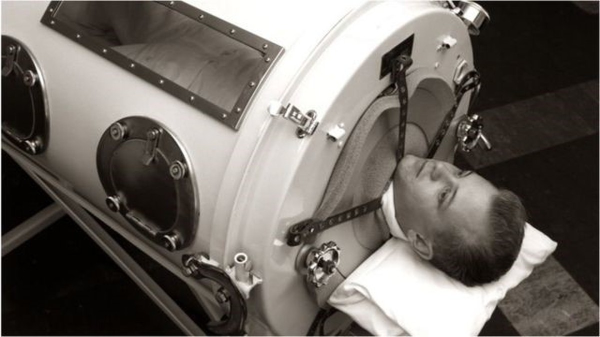 Por que poliomielite volta a preocupar Saúde G1