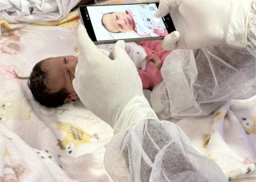 El iris de los ojos también se registra en el proyecto de identificación neonatal de Tocantins — Foto: Difusión/SSP