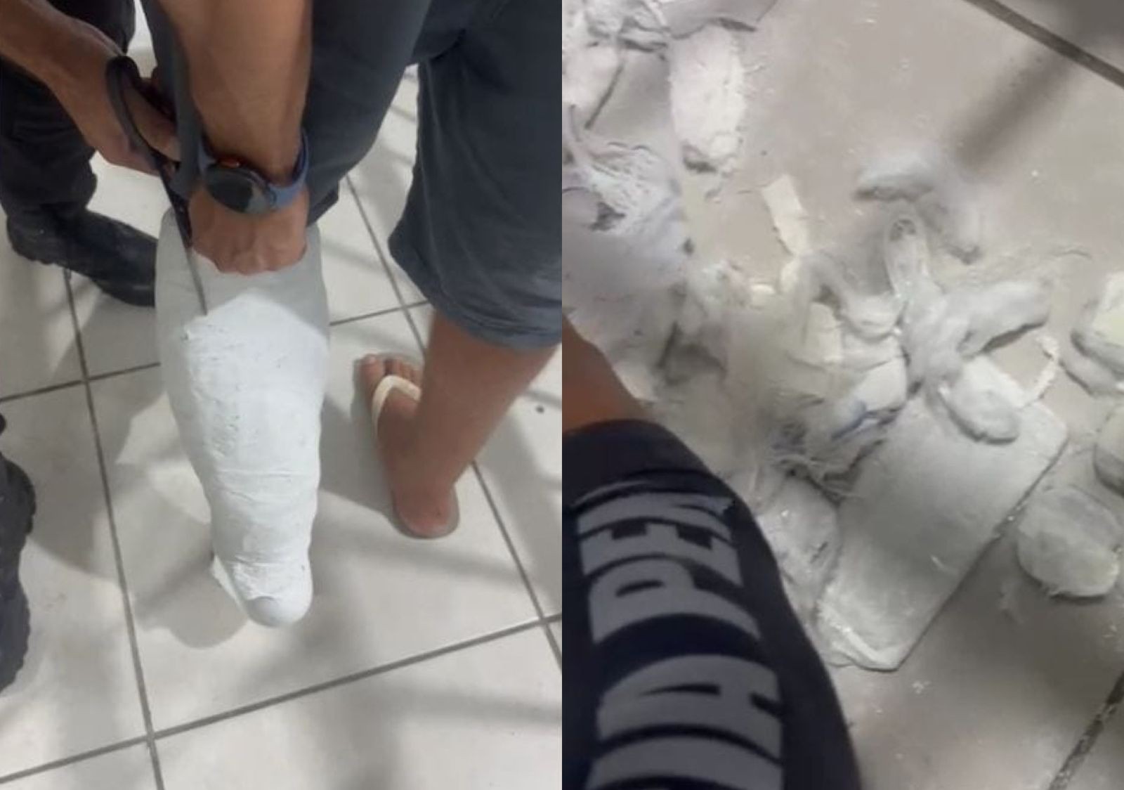 Homem finge estar com a perna quebrada e tenta entrar em presídio com celular e chips escondidos em gesso falso em SC