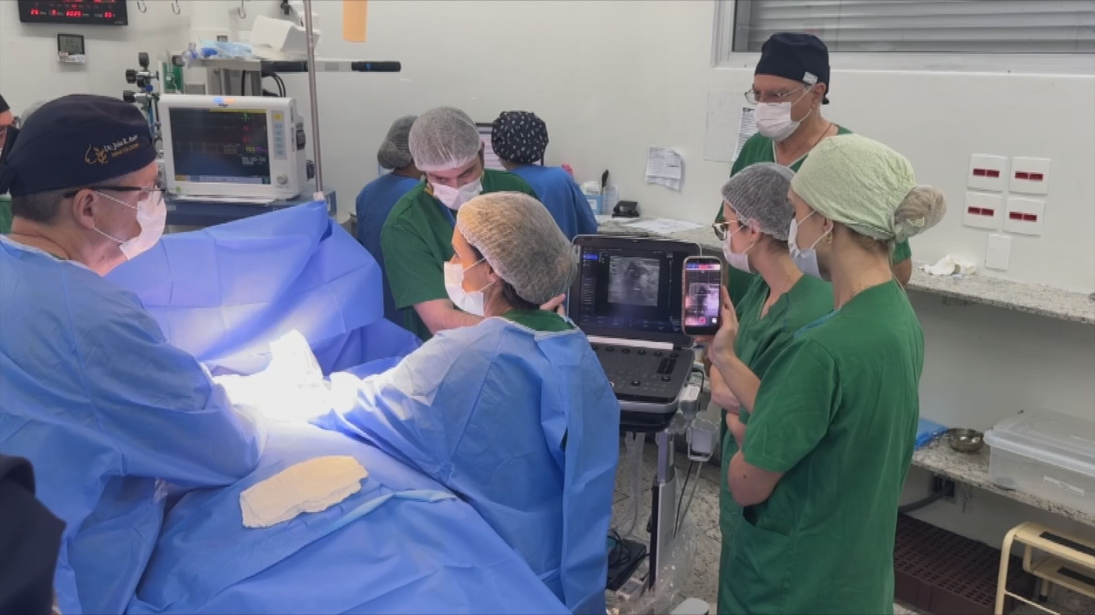 Hospital Amaral Carvalho de Jaú realiza crioablação em paciente com câncer de mama em estudo internacional inédito
