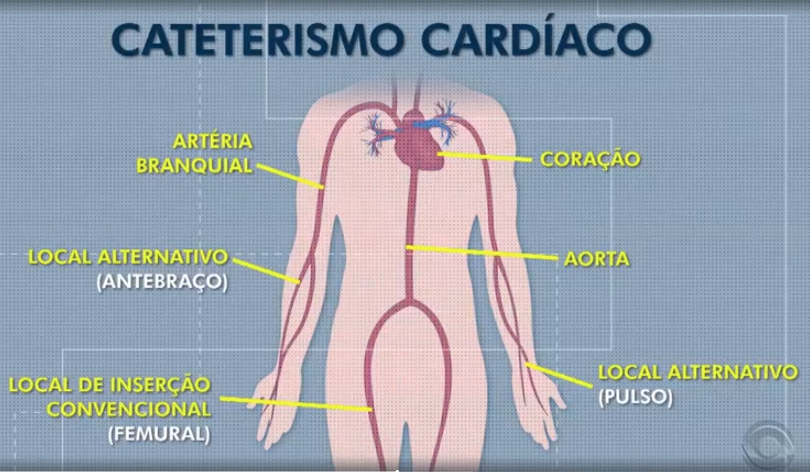 Prefeito Ed Thomas segue internado na UTI sem previsão de alta após passar por cateterismo, em Presidente Prudente 