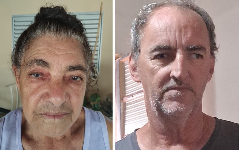 MP vai investigar caso de pacientes que ficaram cegos após mutirão de catarata no interior de SP | Ribeirão Preto e Franca | G1