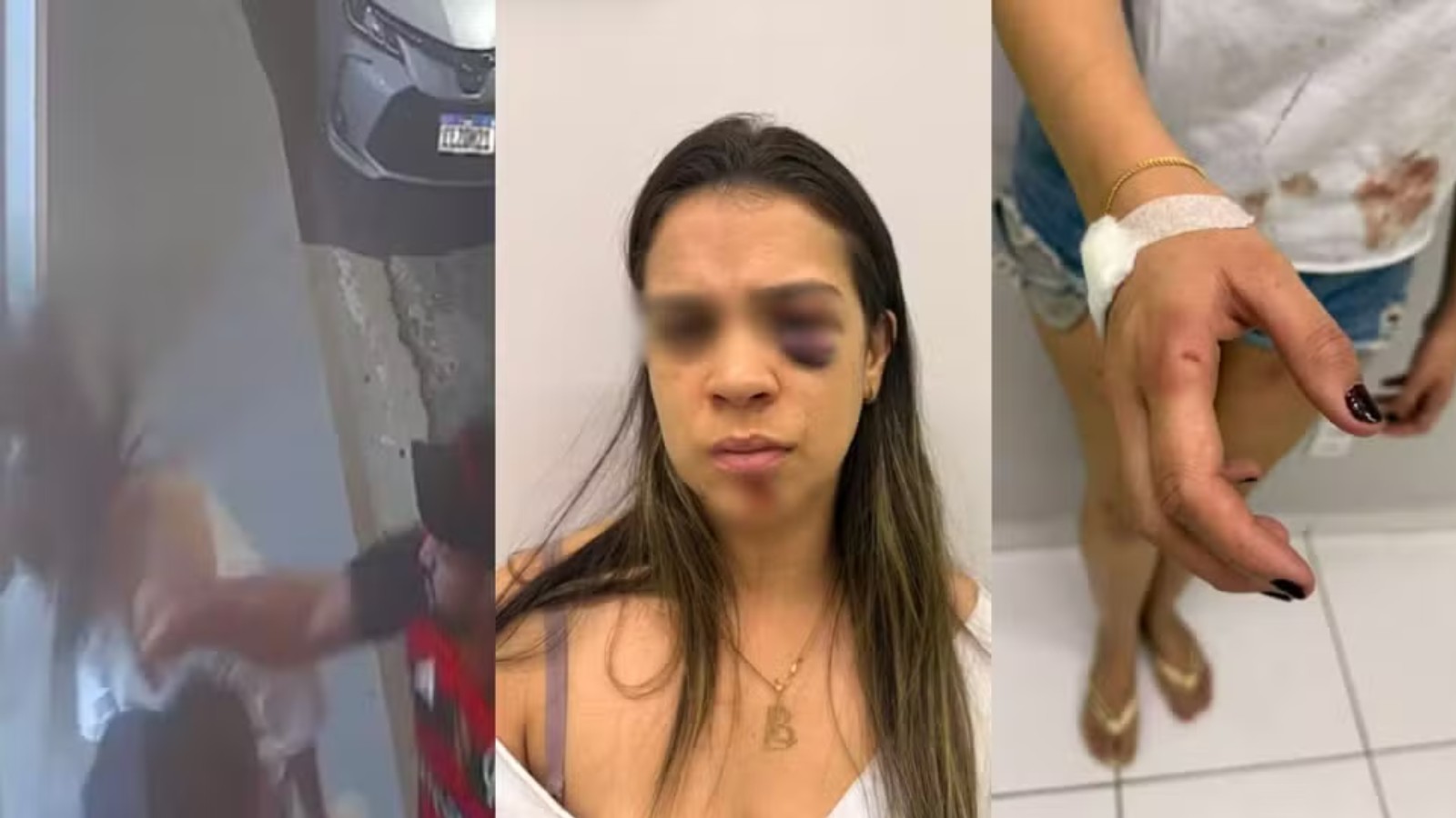 'Ele já me bateu com rodo, mangueira e corrente', diz esposa agredida por mecânico no Piauí