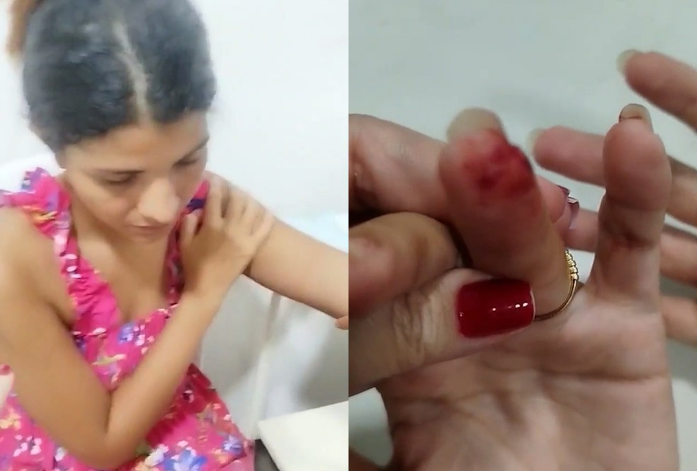 Dona de casa alega que foi agredida por policiais militares no Maranhão — Foto: Reprodução/TV Mirante