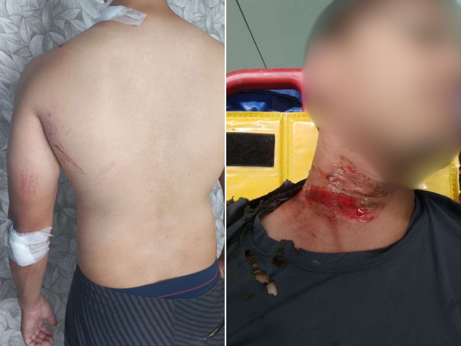 Motociclista que se acidentou após enroscar em fiação em Santos, SP, será indenizado