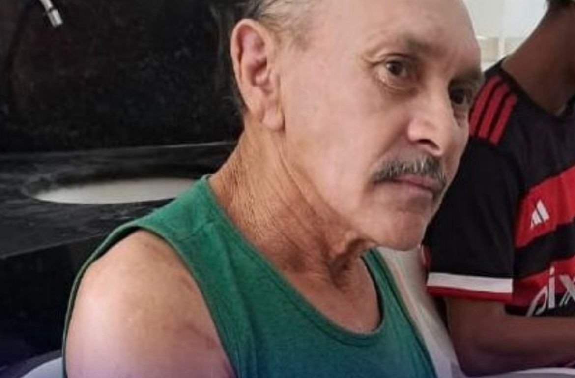 Homem morre após ser atropelado por caminhão, no Agreste da Paraíba