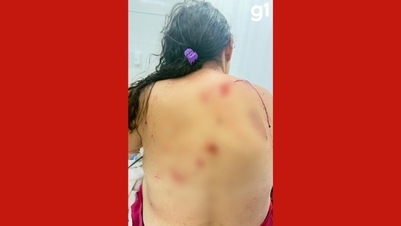 Mulher é esfaqueada após ser enganada pelo ex
