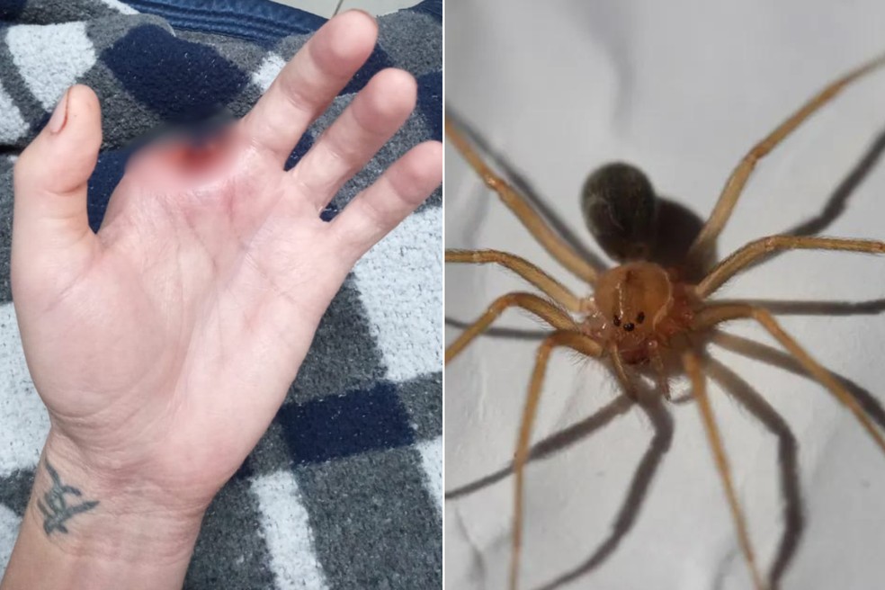Homem picado por aranha venenosa tem dedo amputado e vive a síndrome do  membro fantasma: 'sinto coçar' | Santos e Região | G1