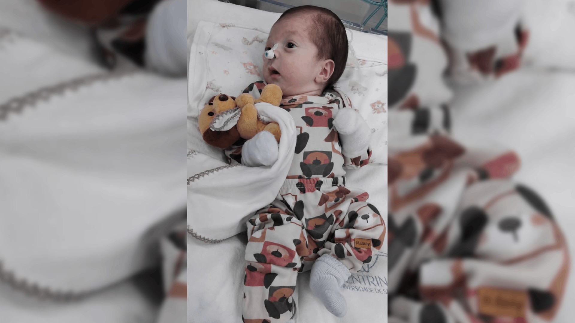 Bebê dado como morto deixa UTI e respira sem aparelhos em Bauru
