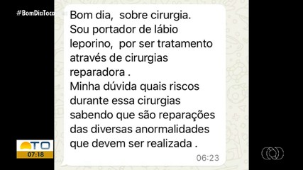 Bom Dia Responde tira dúvidas sobre lábio leporino