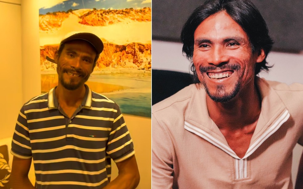 Antes e depois de Tiago Viana: cantor passou por tratamento odontológico, cortou o cabelo, fez a barba e entrou em estúdio para gravar as primeiras músicas após receber apoio do empresário Rafael Cabral — Foto: Reprodução/Instagram de Tiago Viana