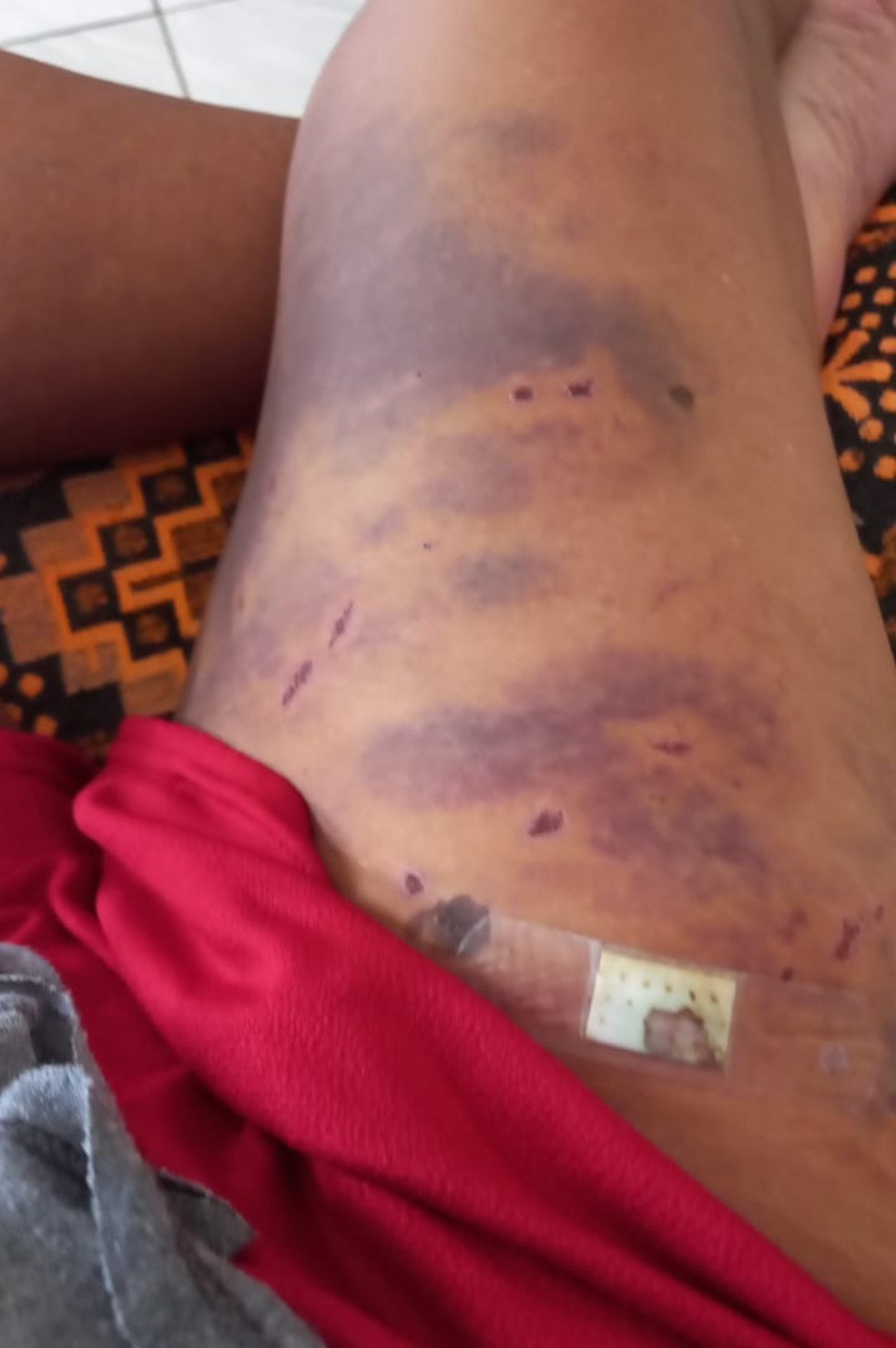 Maria ficou toda machucada com as mordidas que levou — Foto: Cedida