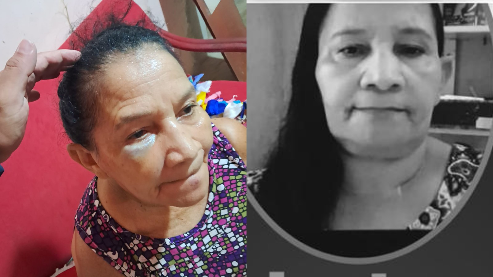 Idosa morre após agressão com mordidas no PI; mulher é suspeita por ciúmes, diz polícia
