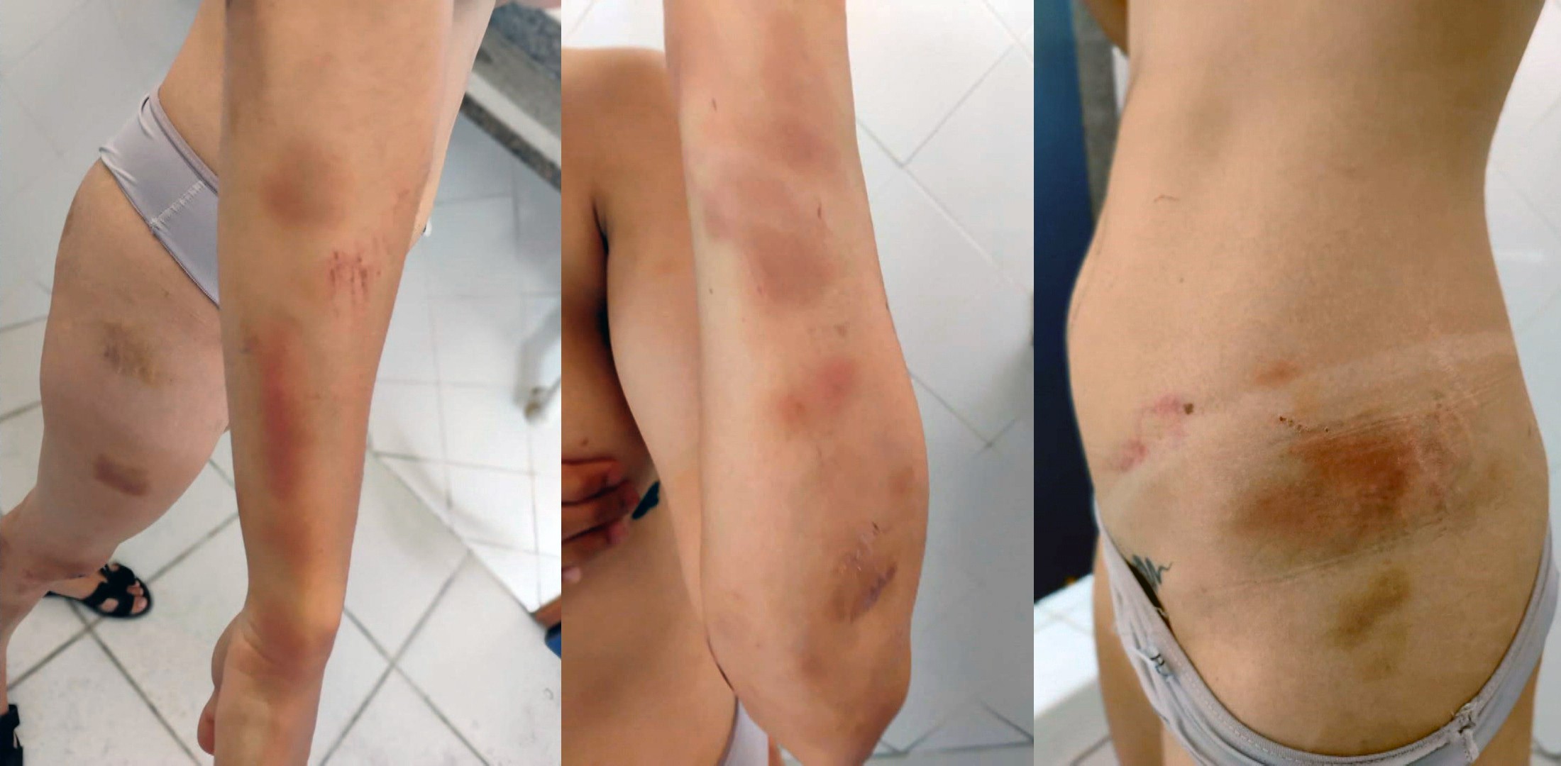 Mulher é presa por cárcere privado e tentativa de feminicídio contra ex-companheira em Nova Iguaçu