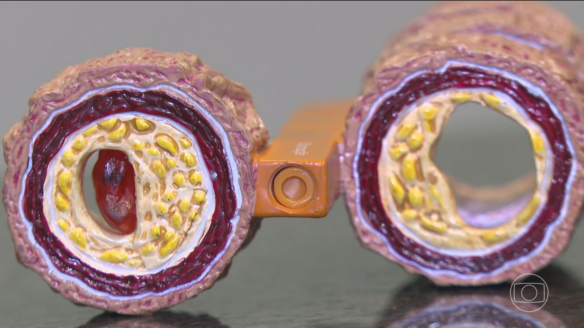 Você Não Tá Convidada pro Meu Bat Mitzvá!