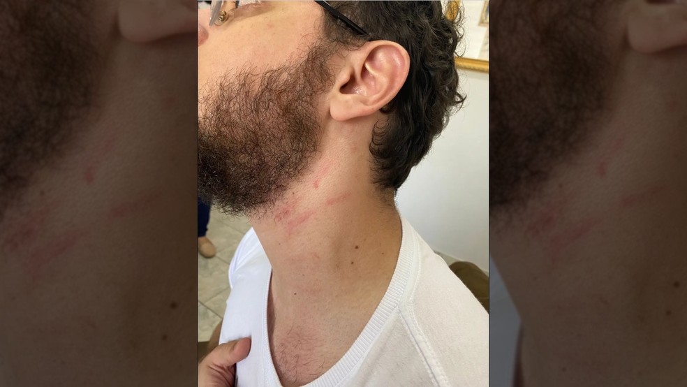 Professor afirma que foi enforcado por delegado da PF — Foto: Arquivo Pessoal