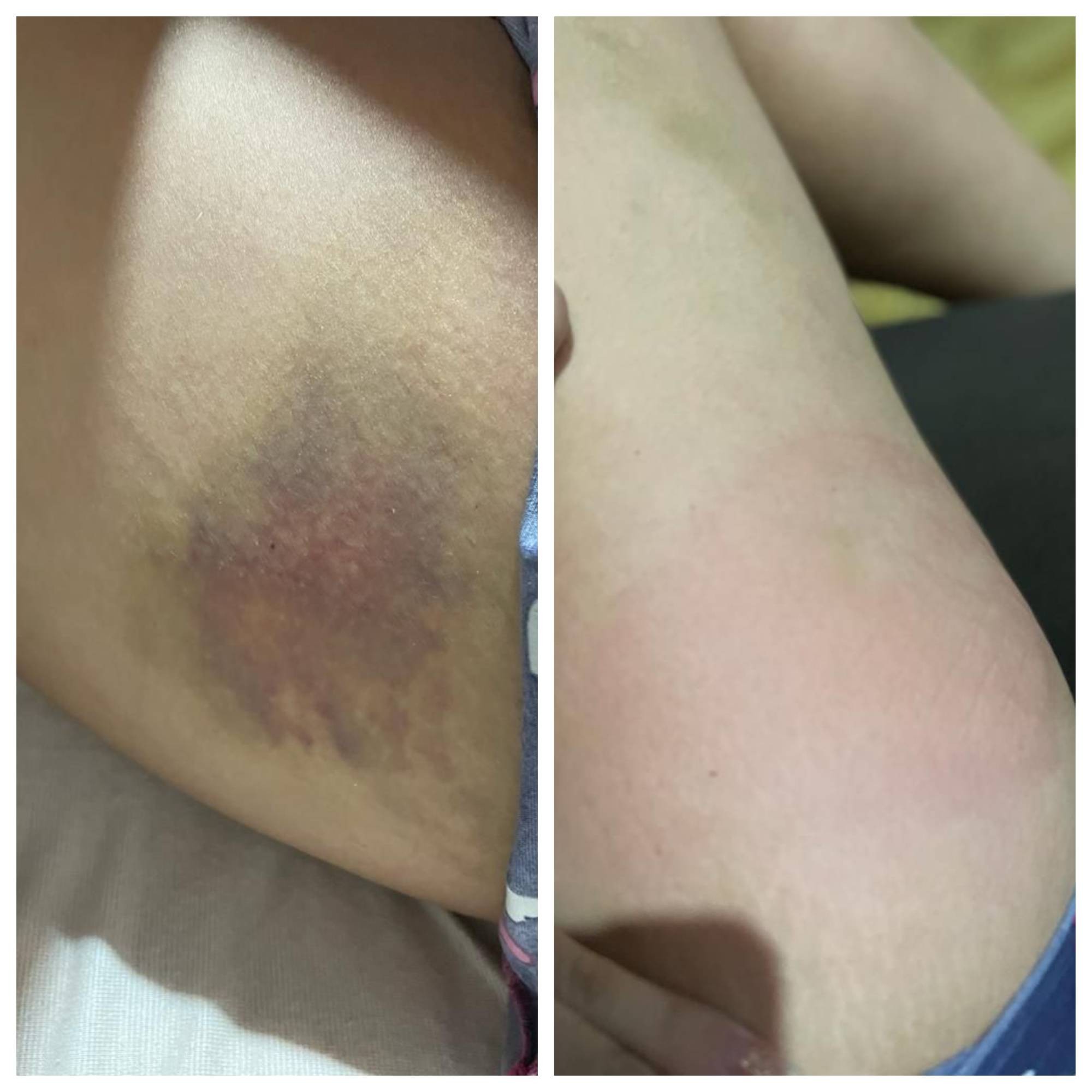Justiça condena influenciador por violência contra ex-companheira em RO