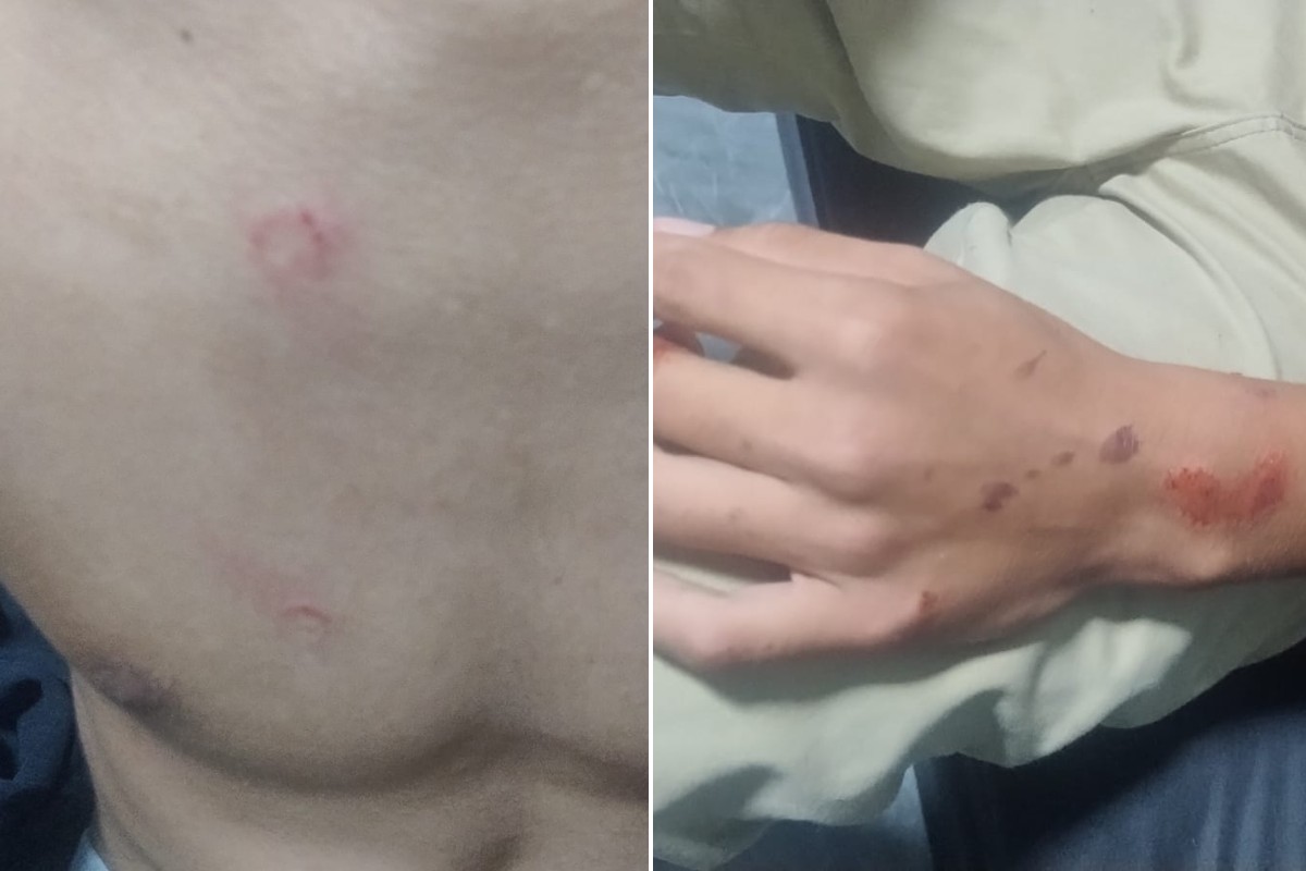 Adolescente atropelado por ônibus a caminho da escola fala pela primeira vez após acidente no litoral de SP
