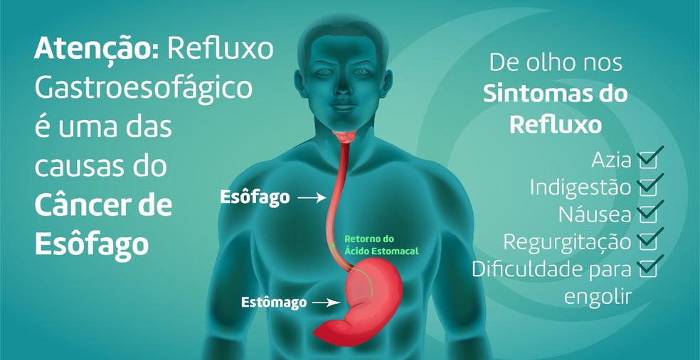 Refluxo e câncer de esôfago, qual a relação? | Oncomed MT, dedicação e  cuidado a favor da vida | G1