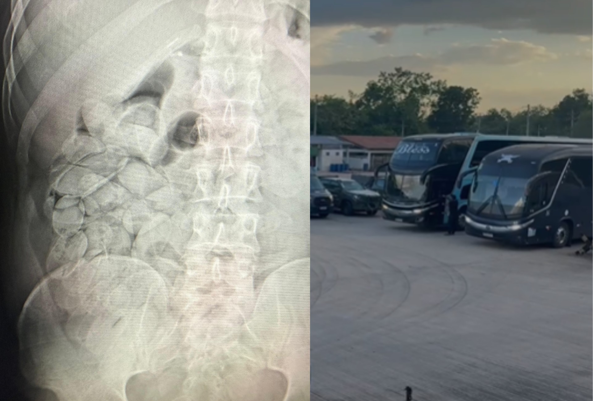 Grupo com 17 pessoas é detido ao tentar entrar no Brasil com centenas de cápsulas de cocaína no estômago