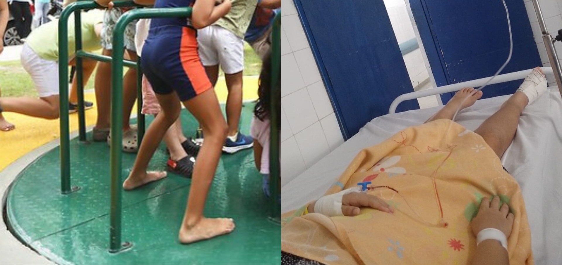 Criança de 8 anos tem dedo do pé amputado após sofrer acidente em brinquedo da Praça da Infância, no Recife