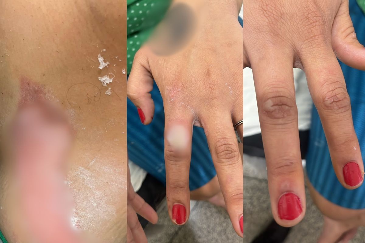 Homem é preso suspeito de atear fogo à companheira após se irritar por ela ter pintado as unhas de vermelho, no PR